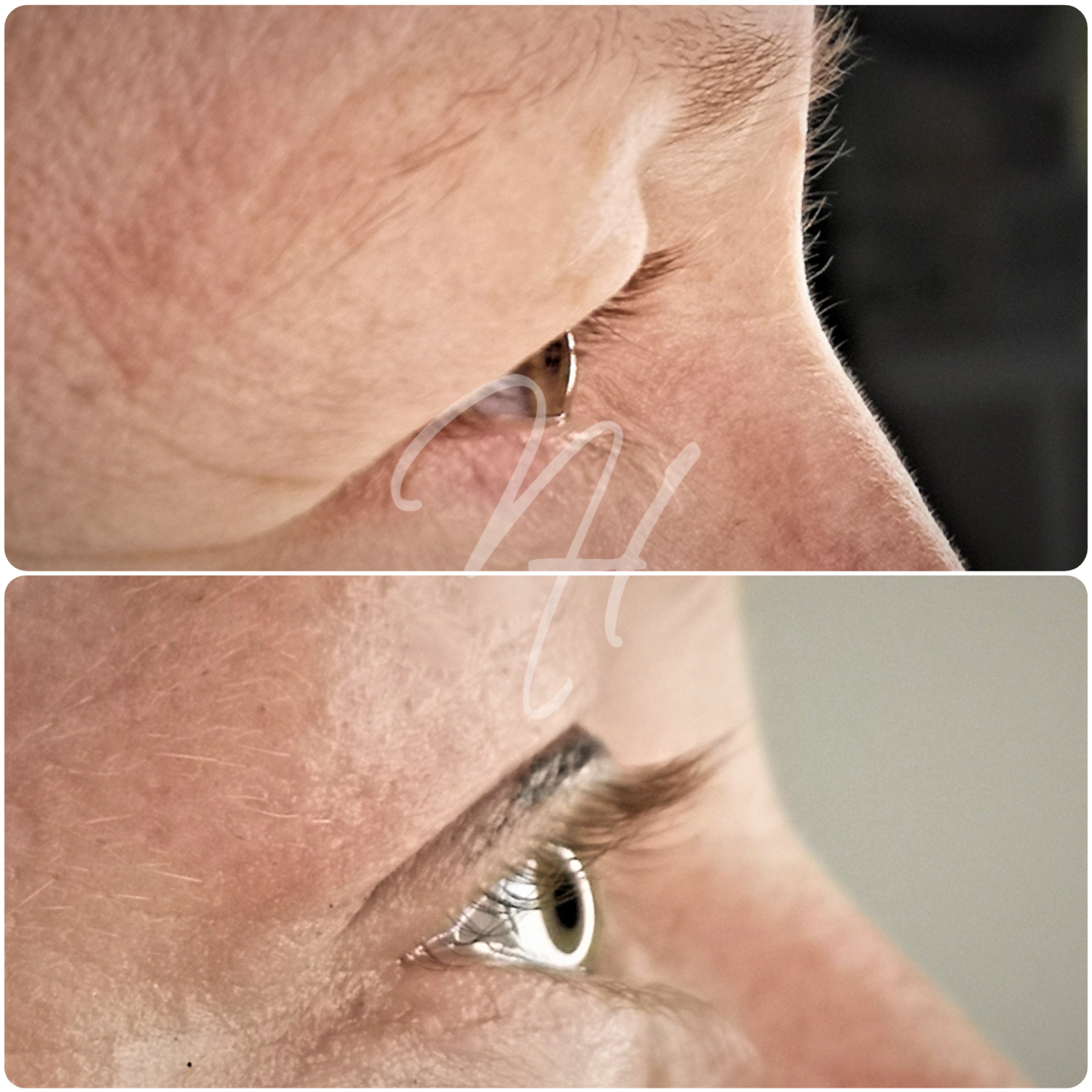 Wimpern- & Augenbrauenlifting