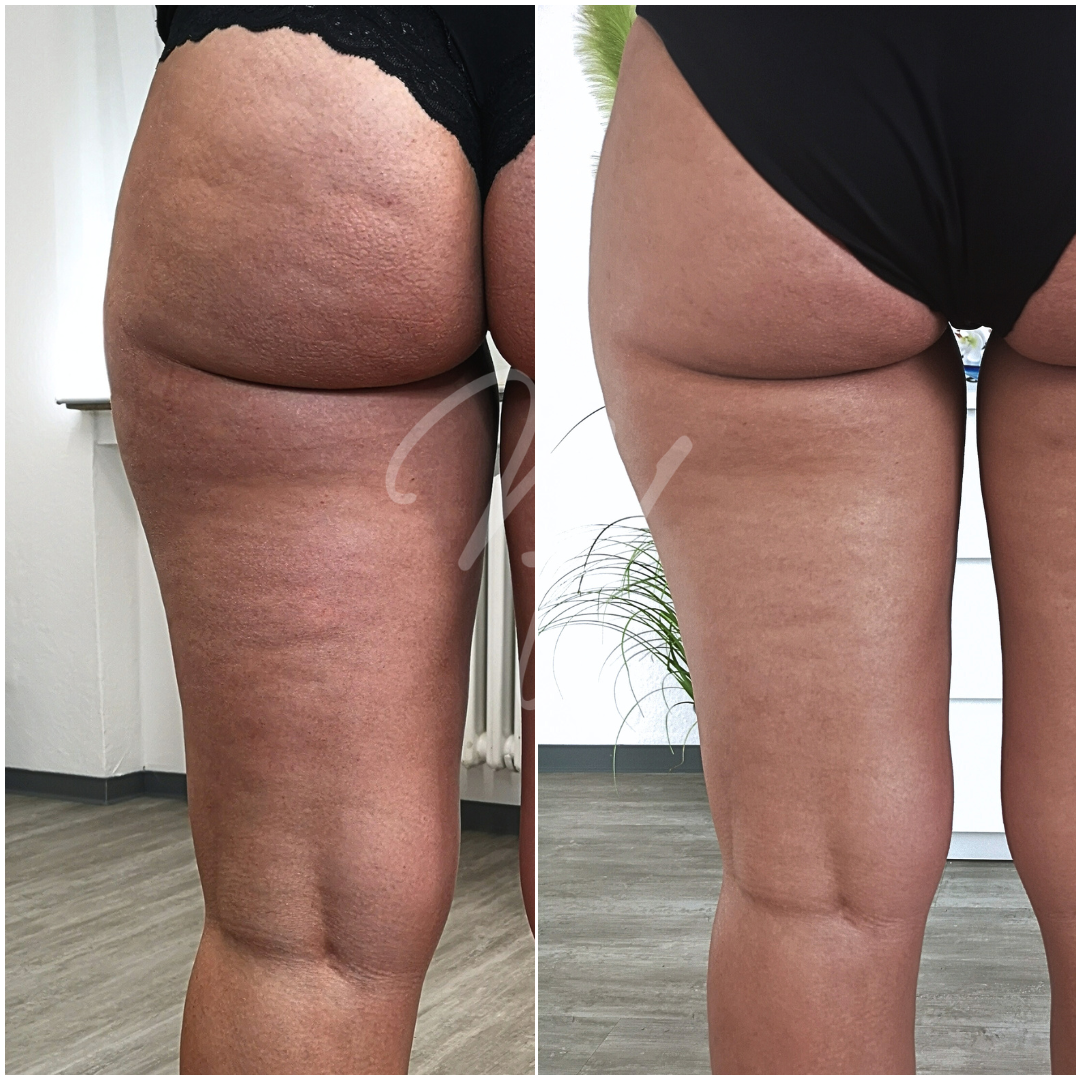 SPA Body Körperbehandlungen